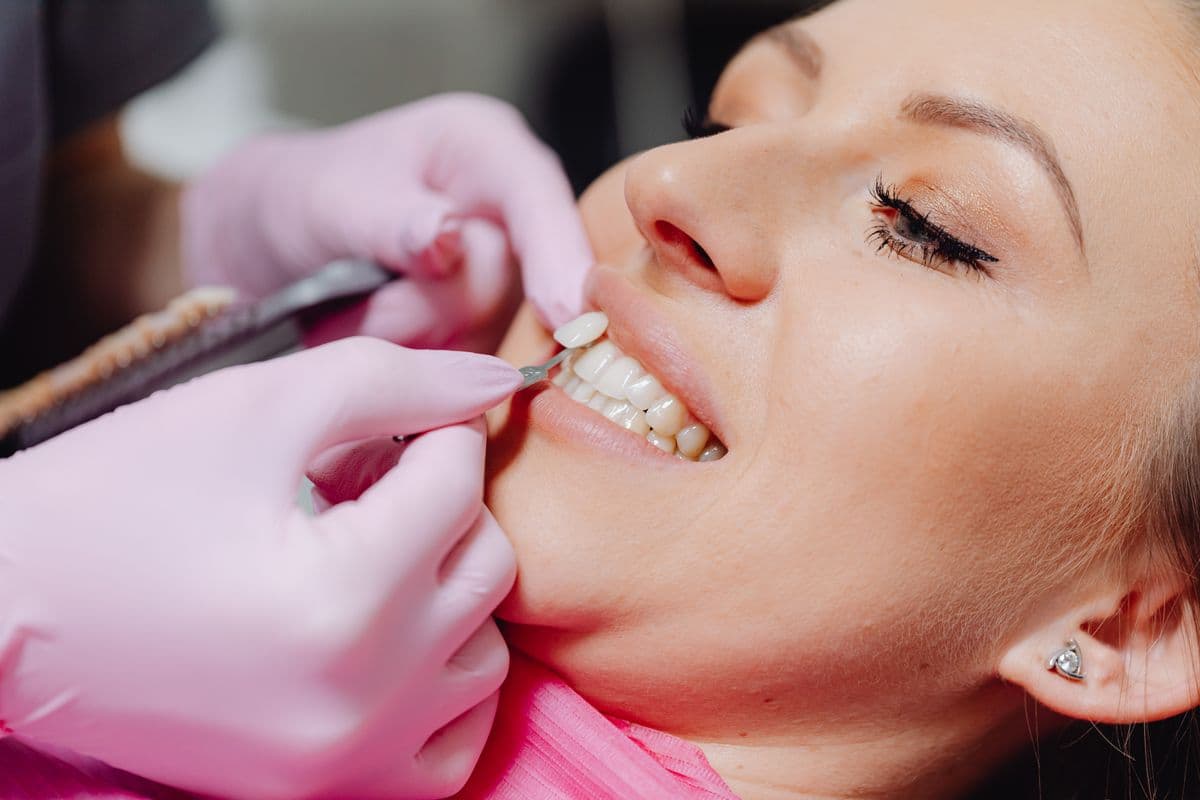 Close up of luxury dental ceramic porcelain veneers being applied